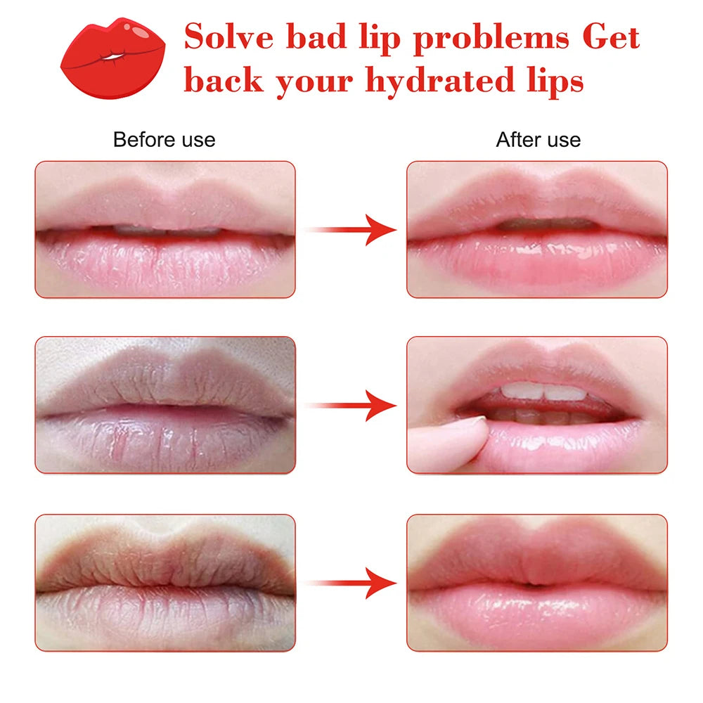 Cherry Vitamin Lip Mask Mositurizing Skin Improve Dry Remove Dead Skin Lip Patches Brighten Colors Skin Care Patches for Lip